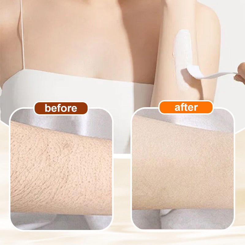 💥Buy 1 Get 1 Free🔥🌸Versatile Aromatic Mild Formula Hair Removal Cream