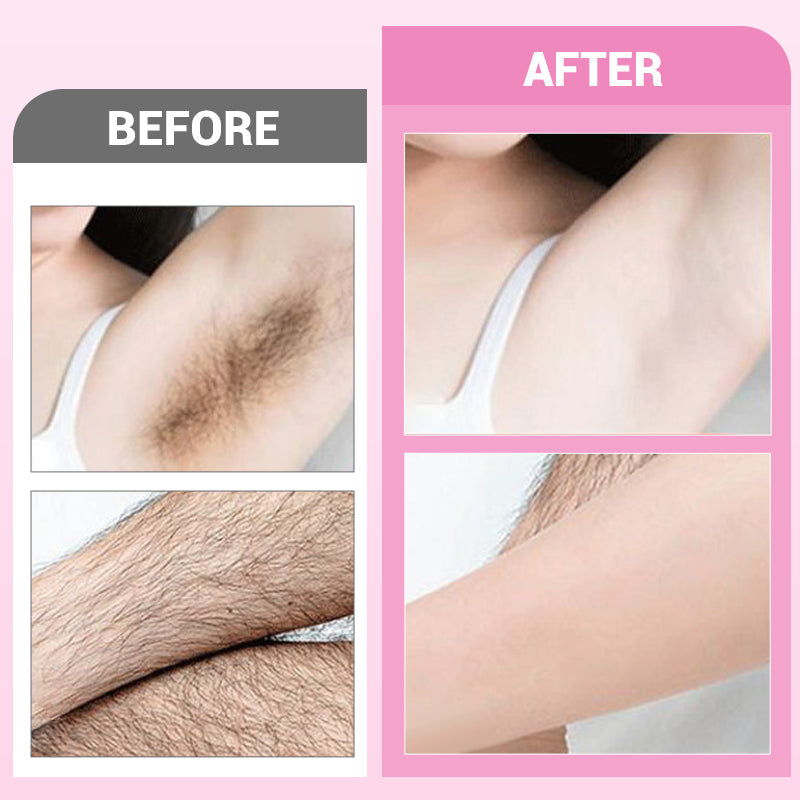 Sensitive Skin Hair Removal Cream