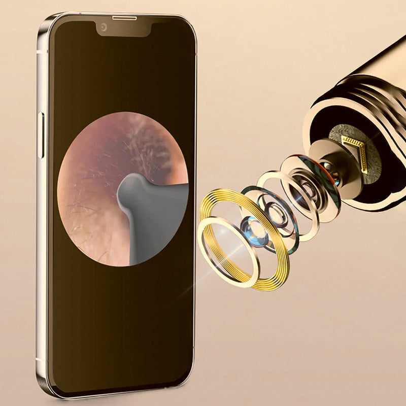 Intelligent Ultra HD Visual Ear Pick Set