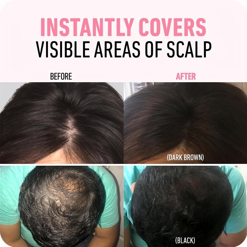 🔥BUY 1 GET 1 FREE💗Hairline Powder  (fit all hair color)