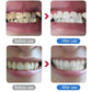 Electric Ultrasonic Dental Scaler for Tartar and Plaque Removal
