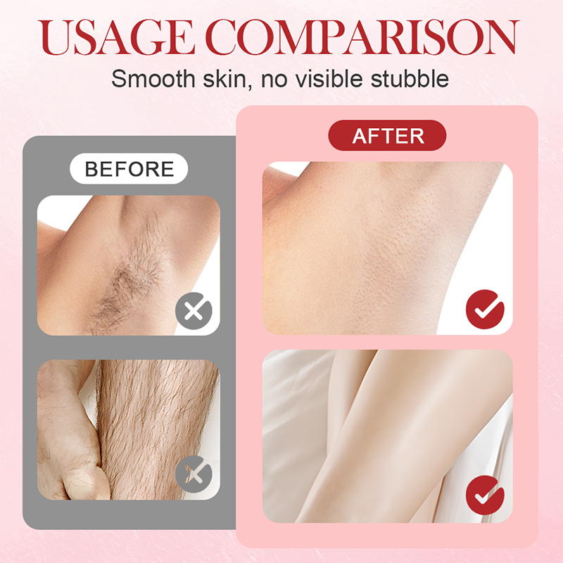 🔥Hot Sale Deals-Portable Dual-Head Electric Epilator